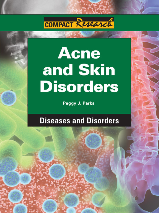 Title details for Acne and Skin Disorders by Peggy J. Parks - Available
